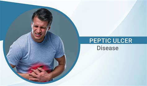 petic|what is a peptic injury.